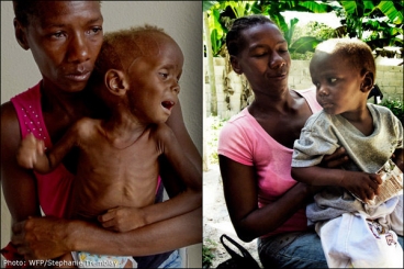 Acute before and after treatment